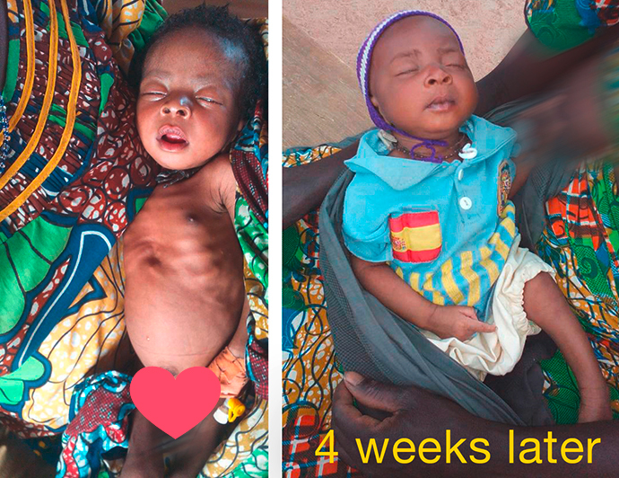 Hungersnot Extrême-Nord Kamerun