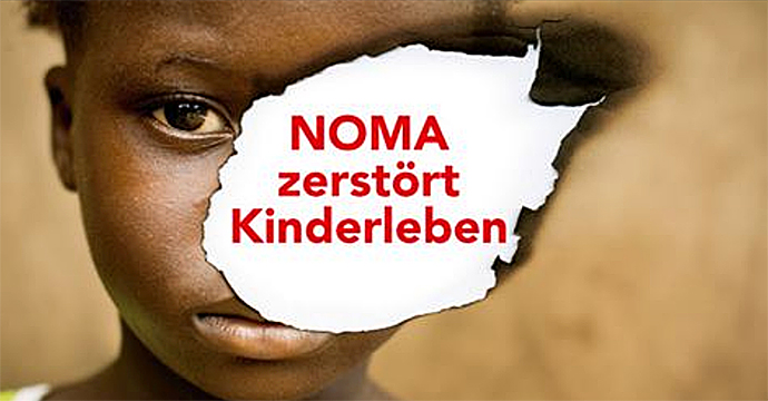 Noma-Hilfe-Schweiz